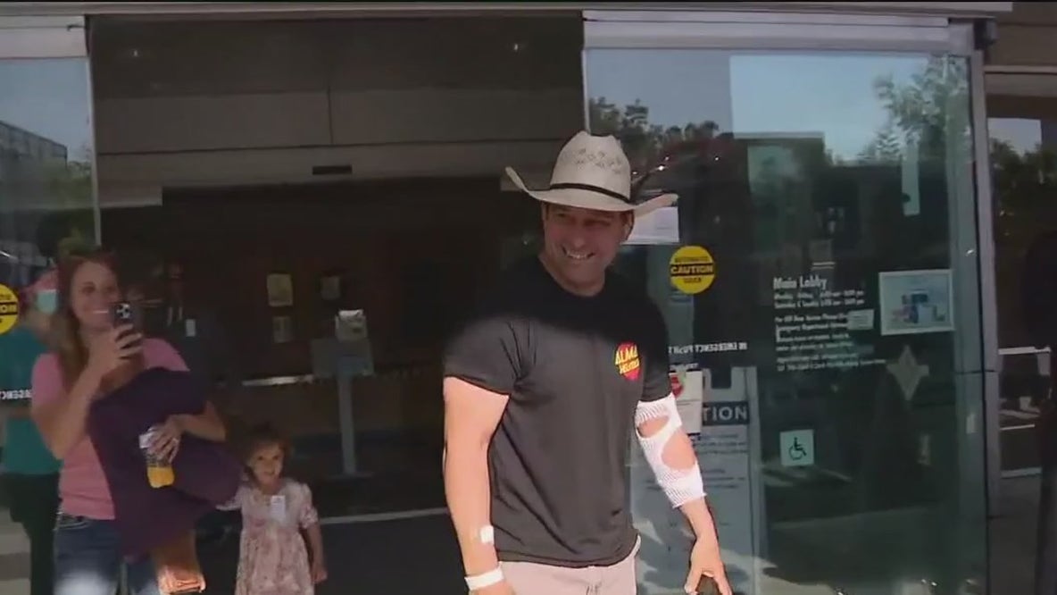 AlCo fireman severely burned in Corral fire released from hospital